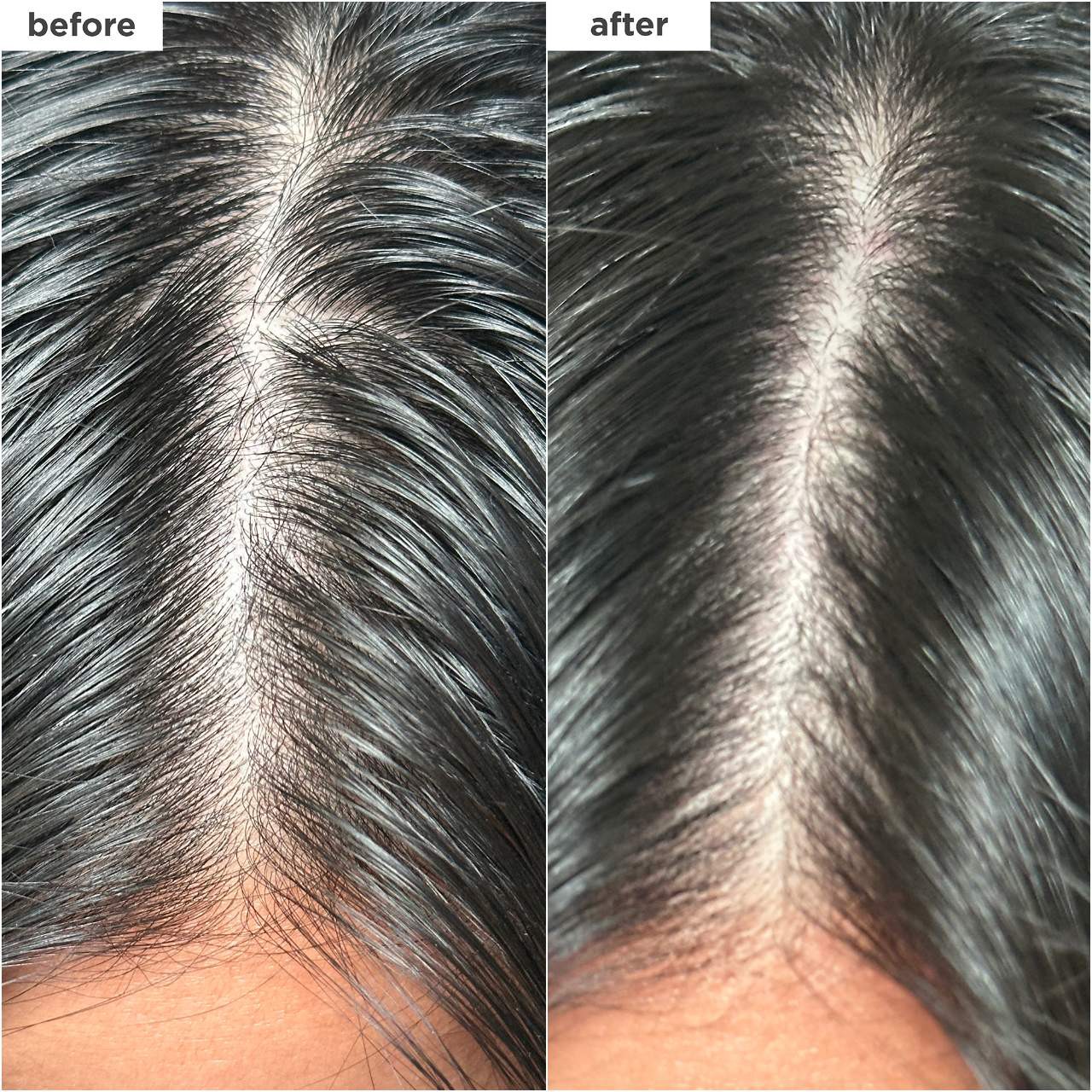slide 4 of 9, Briogeo Scalp Revival Charcoal + Biotin Dry Shampoo 1.7 oz/ 50 mL, 