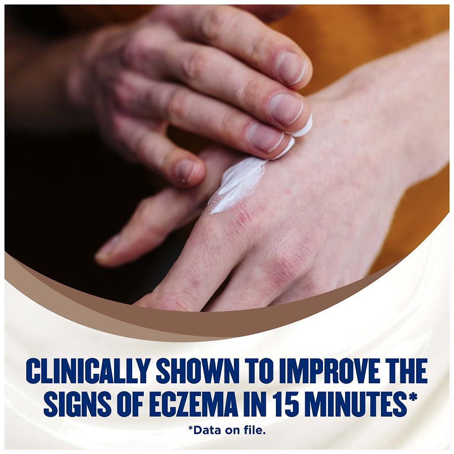 slide 2 of 5, Gold Bond Ultimate Eczema Relief Cream (8 Oz), 8 oz