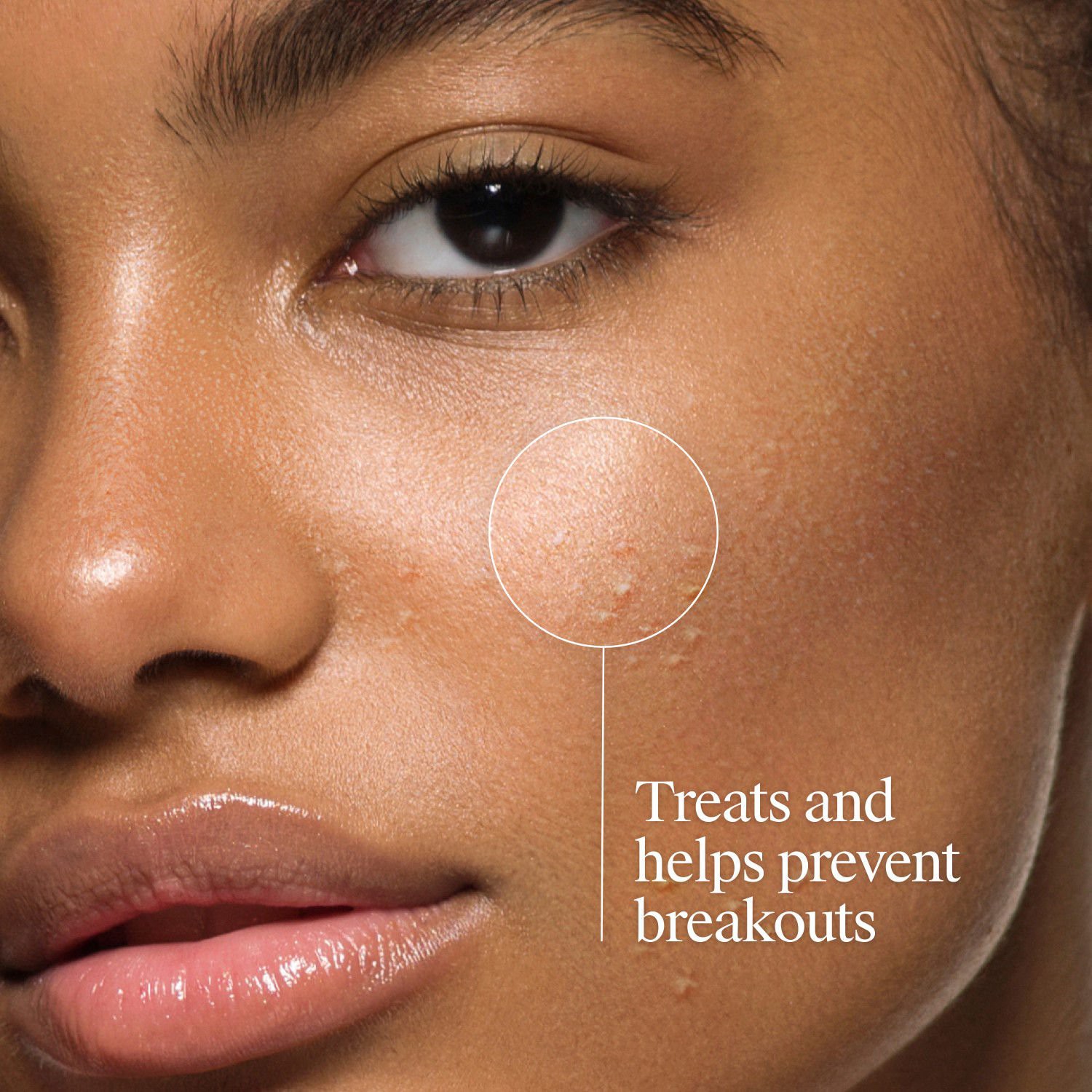 slide 7 of 7, Neutrogena Oil Free Acne Wash, Fragrance Free 9.1Oz, 9.1 oz