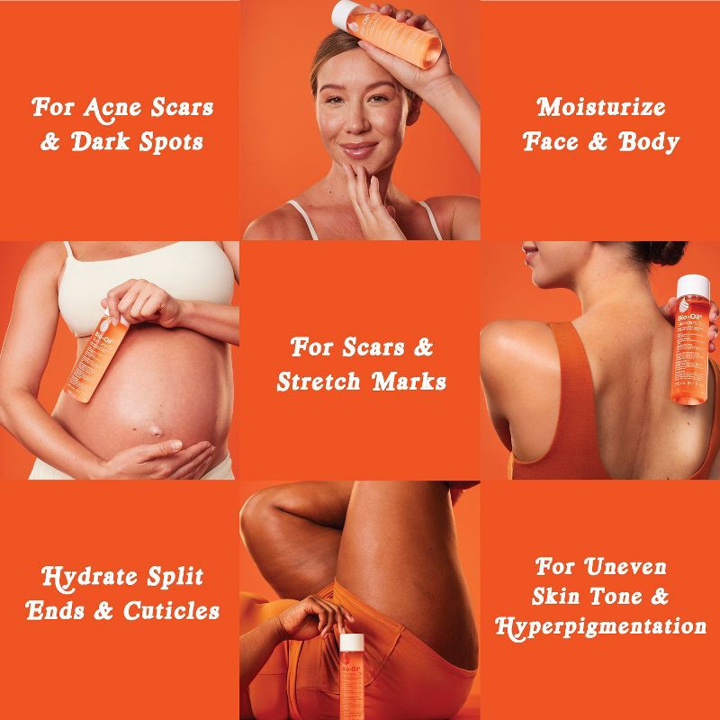 slide 6 of 9, Bio-Oil Skincare Body Oil and Scar Treatment with Vitamin E - For Stretch Marks, Dark Spots and Acne Scars - 2 fl oz, 2 fl oz
