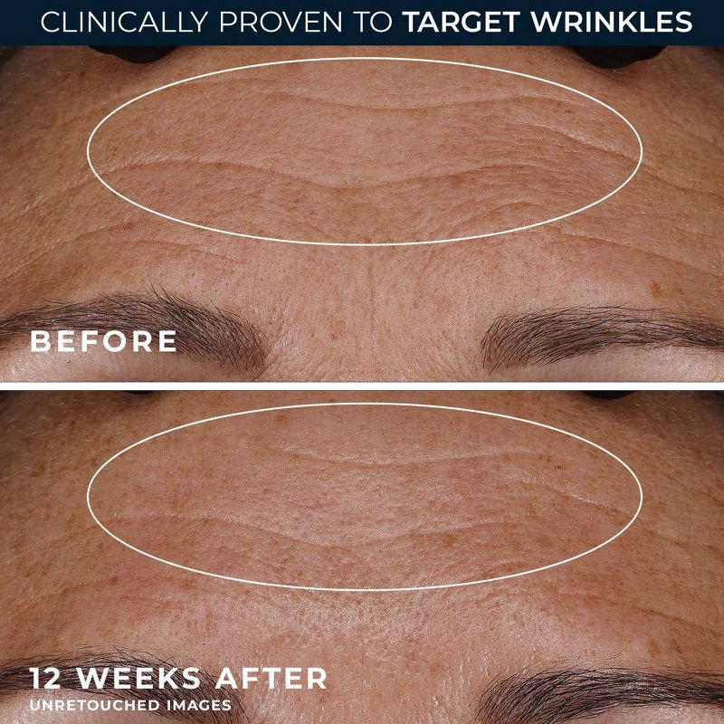 slide 6 of 10, RoC Retinol Anti-Aging + Firming Night Face Moisturizer - 1 fl oz, 1 fl oz