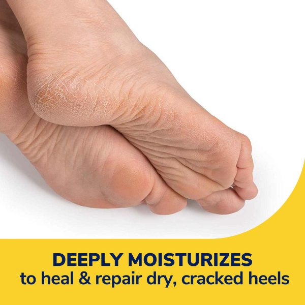 slide 18 of 29, Dr. Scholl's Severe Cracked Heel Repair Restoring Balm 2.5oz, with 25% Urea for Dry, Cracked Feet, Heals and Moisturizes for Healthy Feet, 2.5 oz