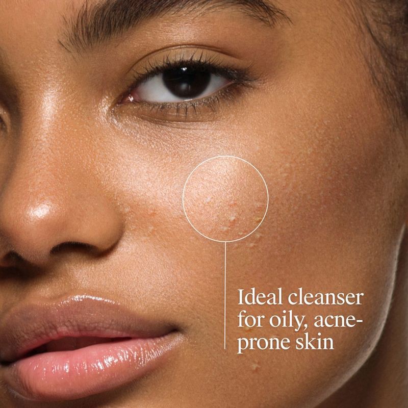 slide 5 of 9, Neutrogena Oil-Free Salicylic Acid Acne Fighting Face Wash - 9.1oz, 9.1 oz