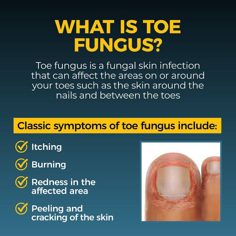 slide 6 of 8, Fungi Nail Anti-Fungal Solution and Brush - 1 fl oz, 1 fl oz