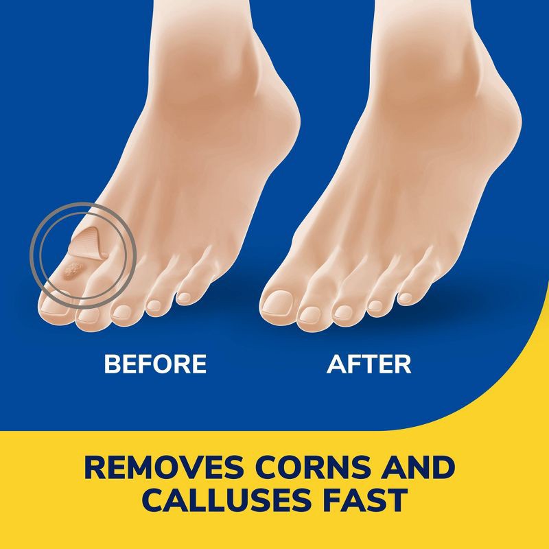 slide 4 of 10, Dr. Scholl's Liquid Corn and Callus Remover - 0.33oz, 0.33 oz