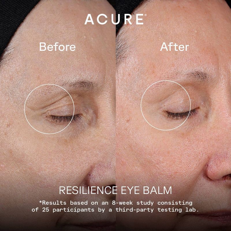 slide 5 of 5, Acure Eye Balm Resilience, 0.5 oz