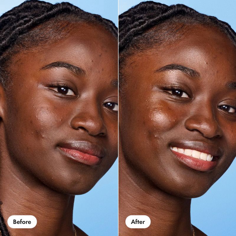 slide 5 of 8, Hero Cosmetics Glow Balm - 0.35oz, 0.35 oz