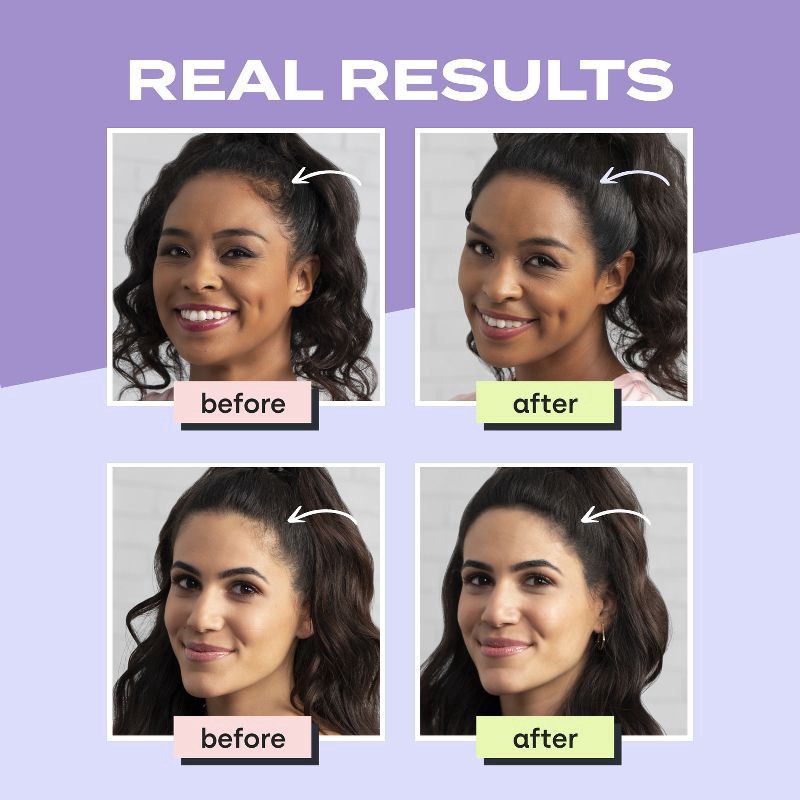 slide 3 of 10, Toppik Hair Filler Med Brown 0.42 Oz, 0.42 oz