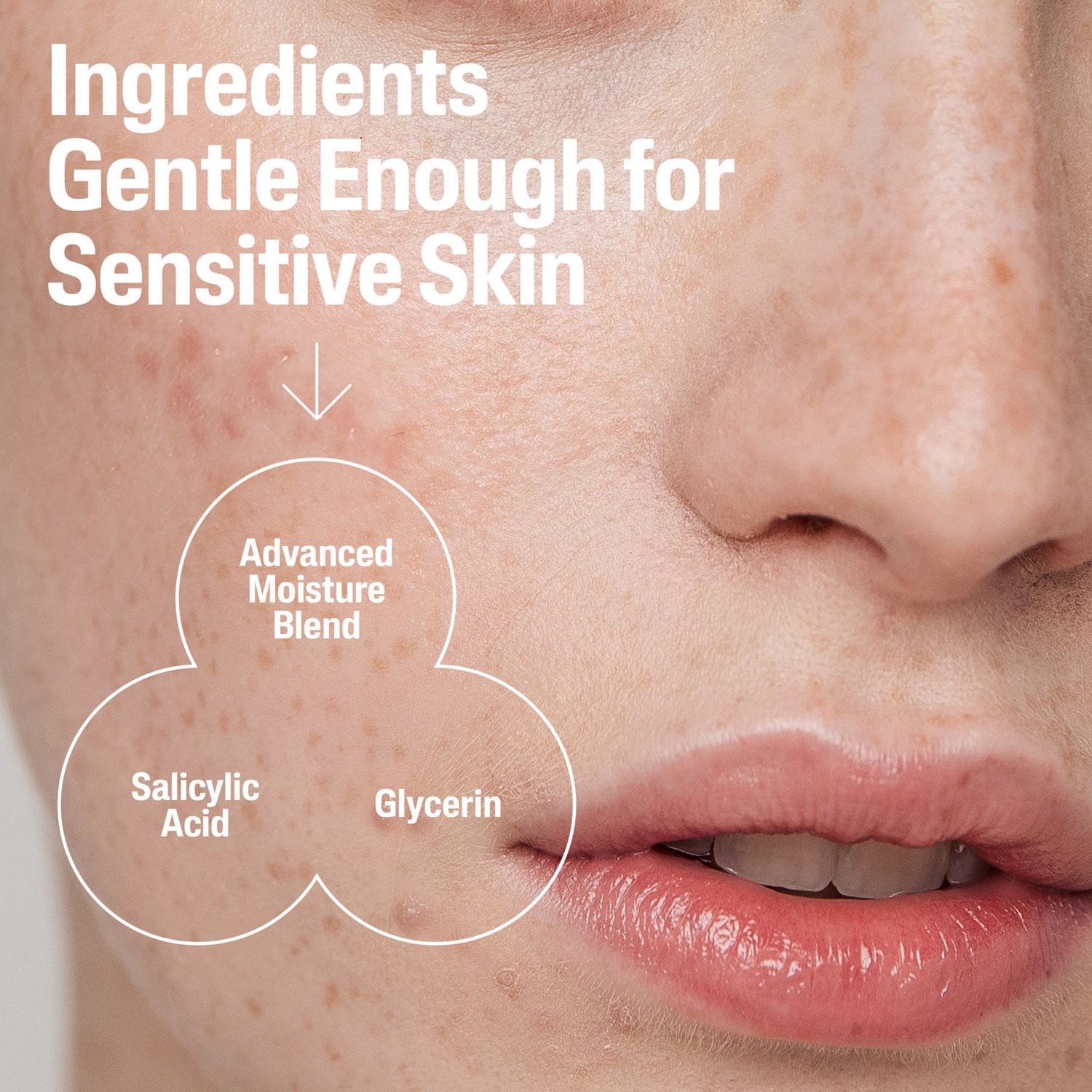 slide 9 of 9, Cetaphil Gentle Clear Pore Clearing Acne Cleanser with 2% Salicylic Acid, 8 fl oz