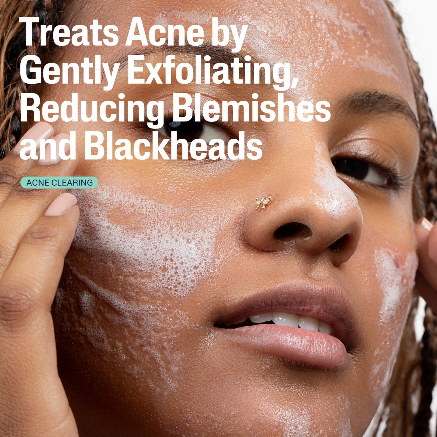 slide 7 of 9, Cetaphil Gentle Clear Pore Clearing Acne Cleanser with 2% Salicylic Acid, 8 fl oz