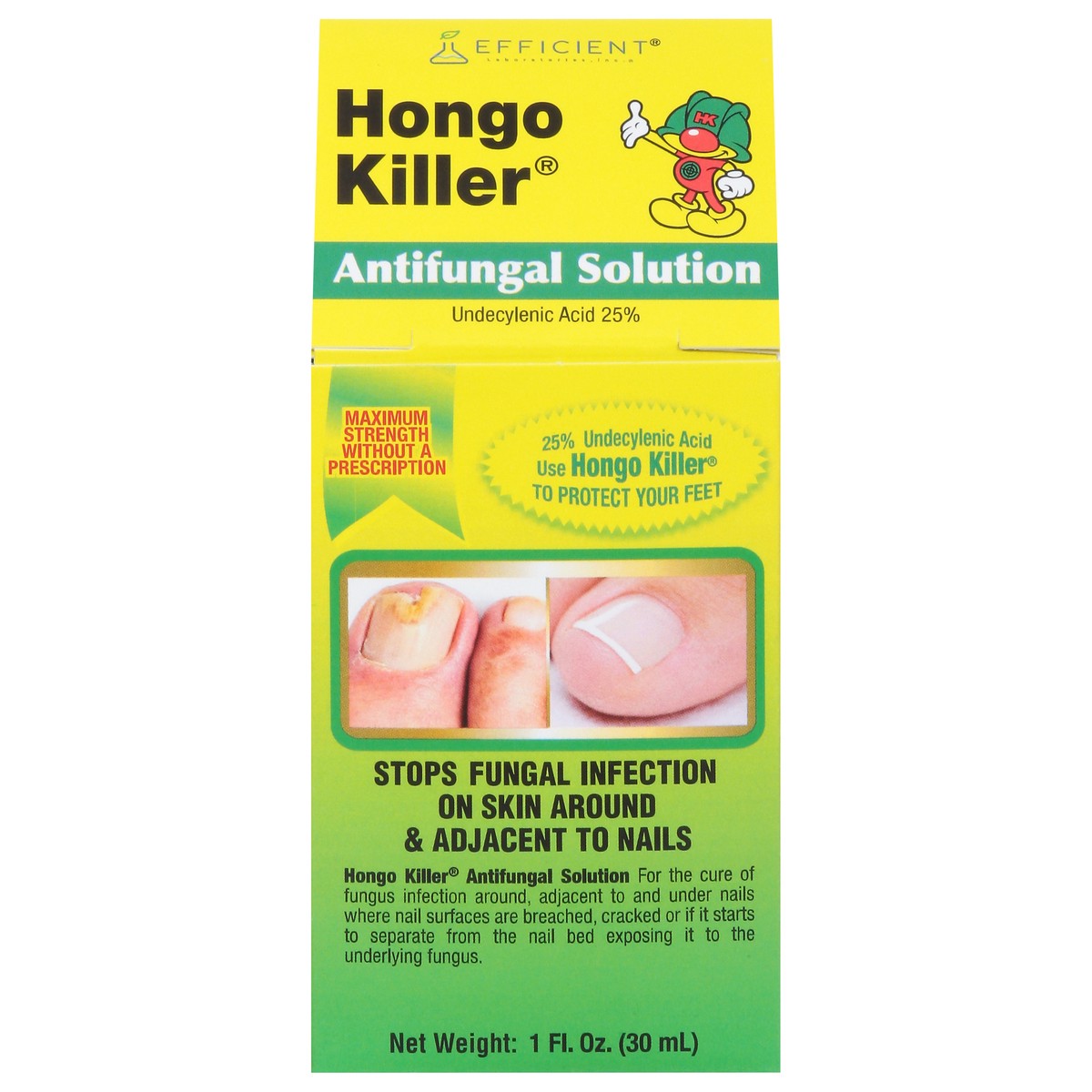 slide 1 of 15, Hongo Killer Maximum Strength Antifungal Solution 1 fl oz, 1 fl oz