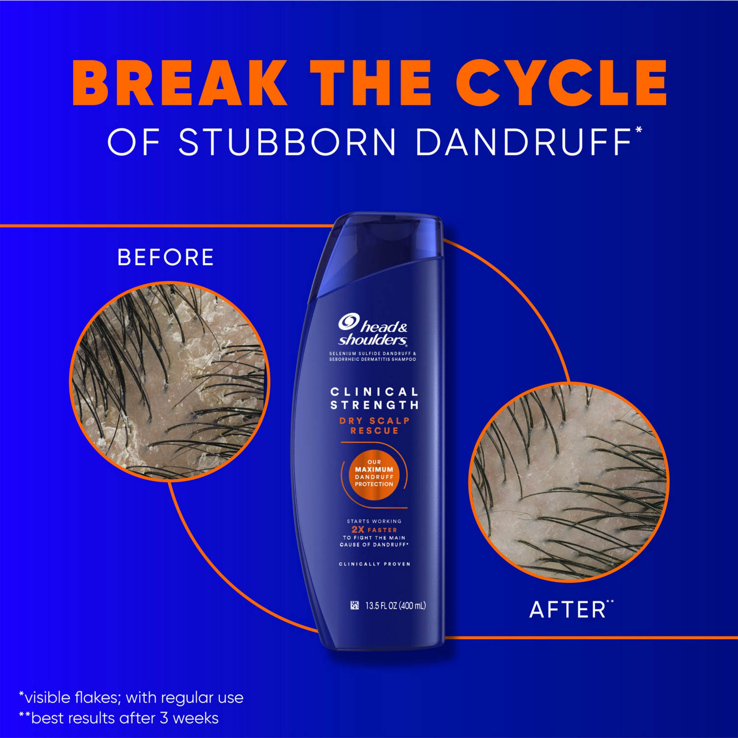 slide 4 of 8, Head & Shoulders Clinical Strength Dry Scalp Rescue Shampoo 13.5oz Twin Pack, for Stubborn Dandruff, 13.5 oz