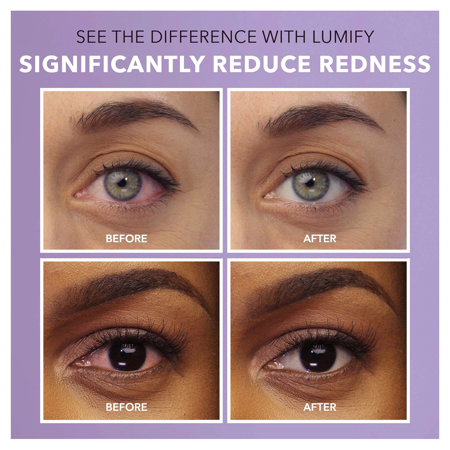 slide 2 of 4, LUMIFY Redness Reliever Eye Drops 0.08 fl oz (2.5 mL), 0.08 fl oz