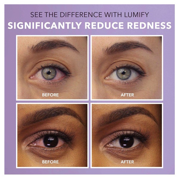 slide 15 of 25, LUMIFY Redness Reliever Eye Drops Large Size 0.25 fl oz, 0.25 fl oz