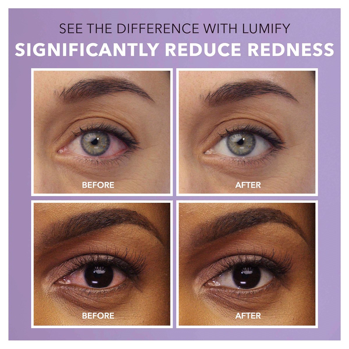 slide 19 of 25, LUMIFY Redness Reliever Eye Drops Large Size 0.25 fl oz, 0.25 fl oz