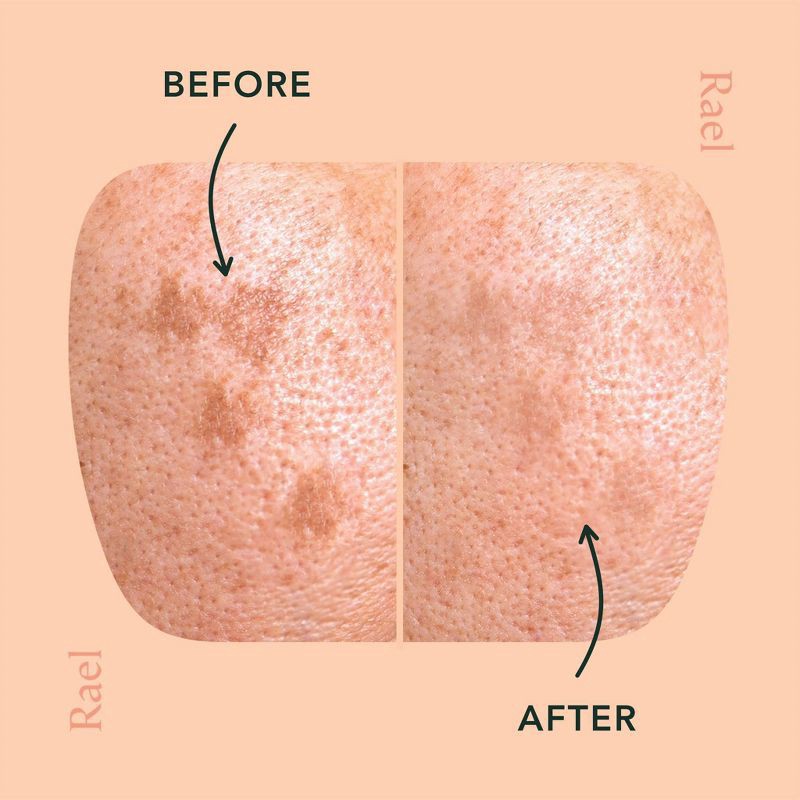 slide 3 of 8, Rael Beauty Miracle Patch Microcrystal Dark Spot Cover, 0.5 oz