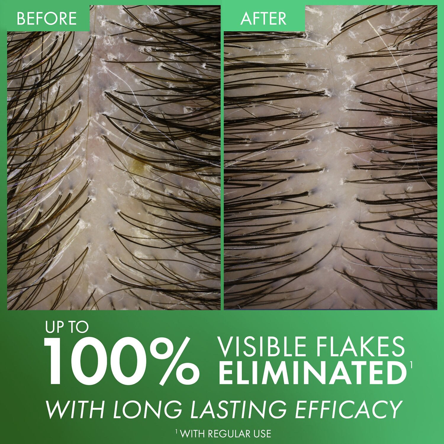 slide 4 of 9, Vichy Selenium Sulfide Anti-Dandruff Shampoo 6.76 fl oz, 6.76 fl oz