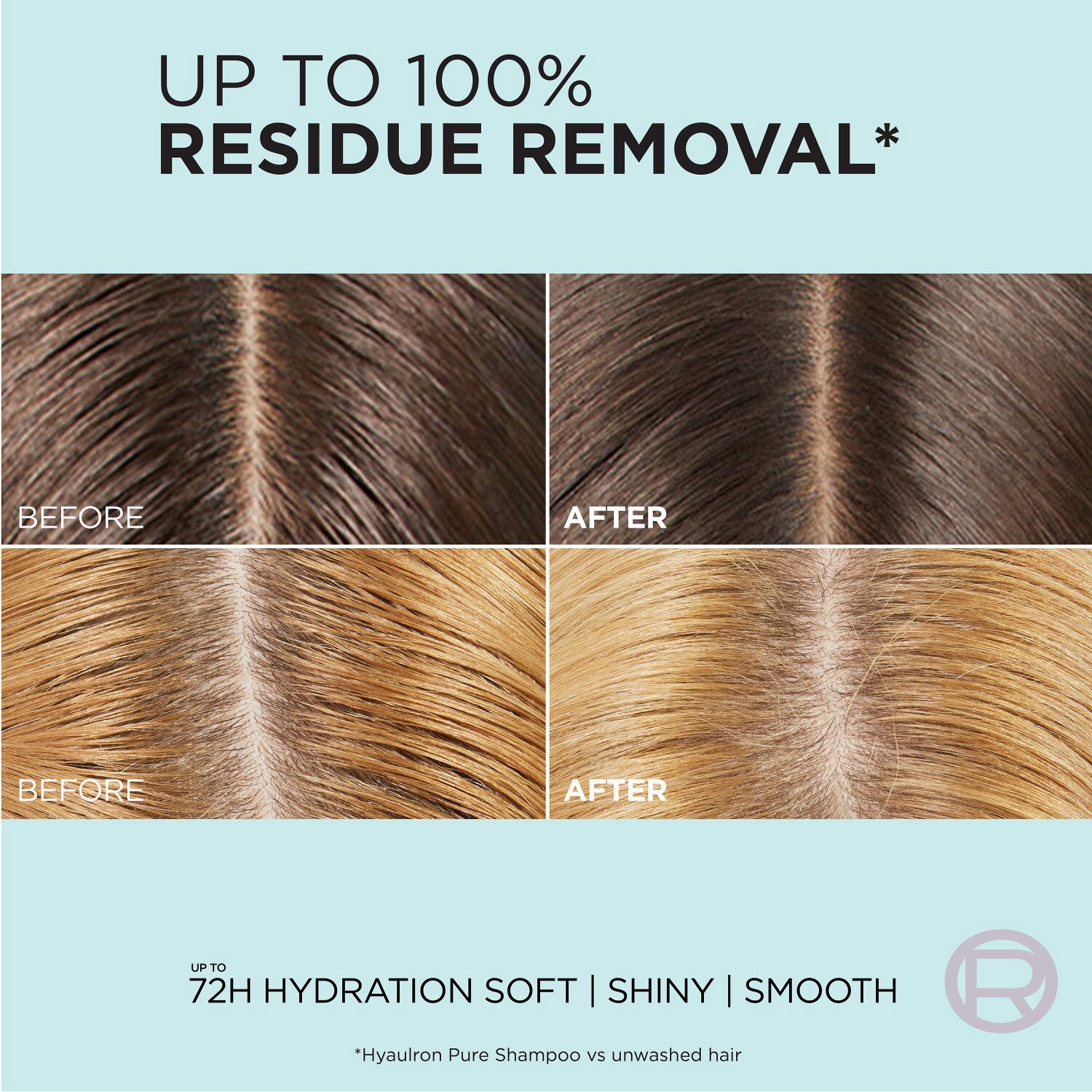 slide 3 of 8, L'Oréal Paris Elvive Hyaluron + Pure Oil Erasing Scalp Serum, 3.45 oz