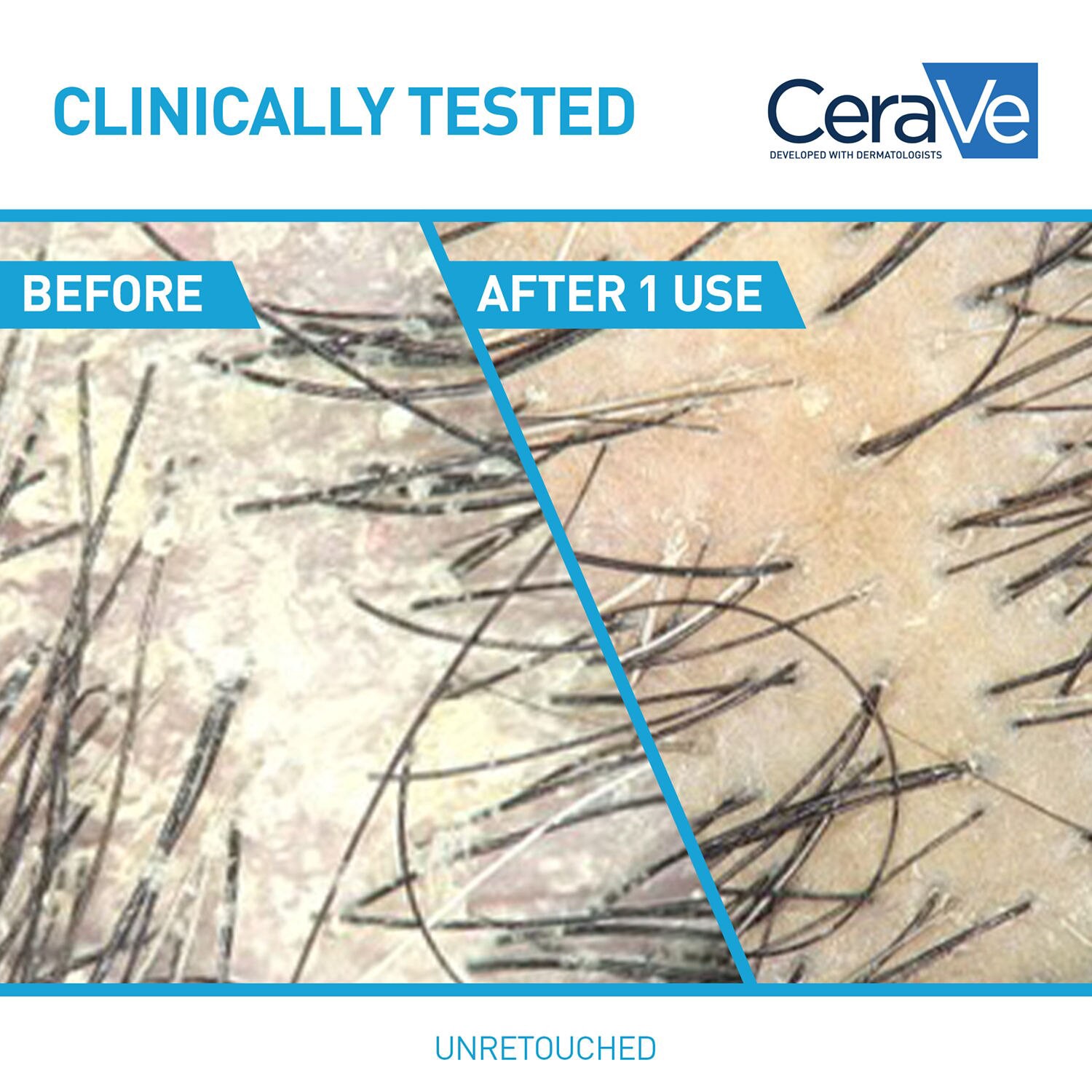 slide 7 of 12, Cerave Hair Anti Dand Conditionr 9 Oz, 9 oz