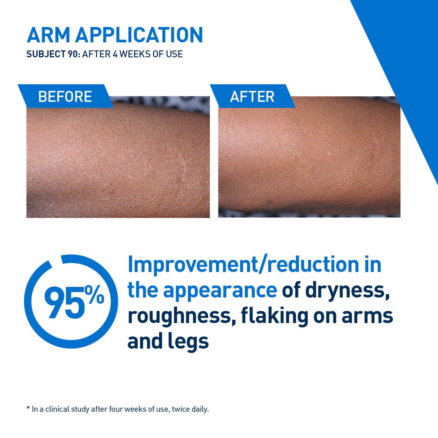 slide 10 of 13, Cerave Intensive Moisturizing Lotion, 16 Oz, 16 oz