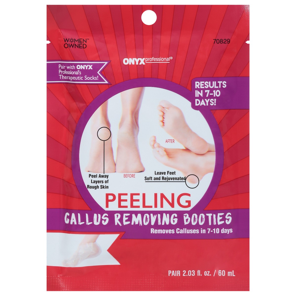 Onyx Professional Peeling Callus Removing Booties Extra Strength Red