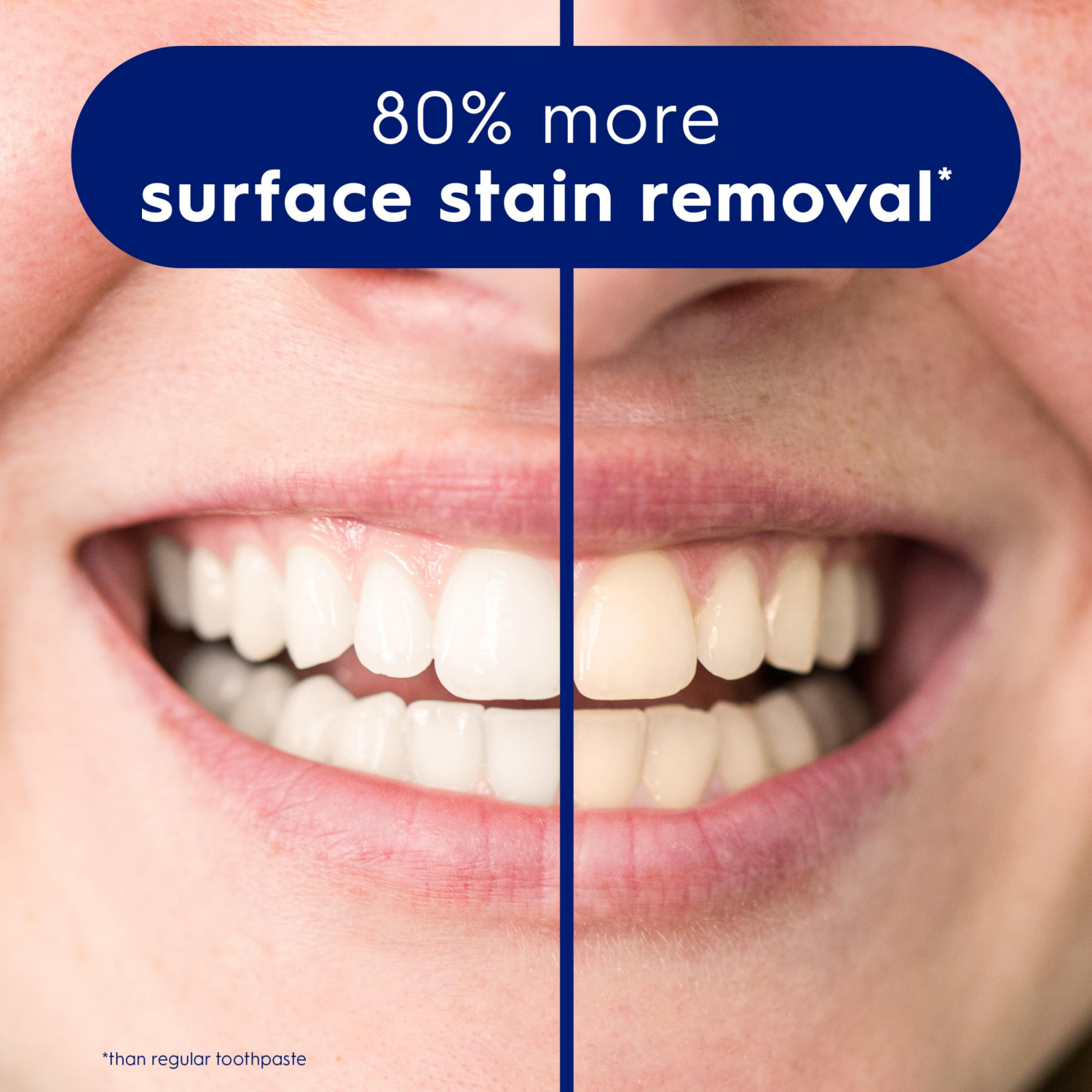 slide 5 of 5, Crest 3D White Stain Eraser Whitening Toothpaste, Fresh Mint, 2.3 oz, 2.3 oz