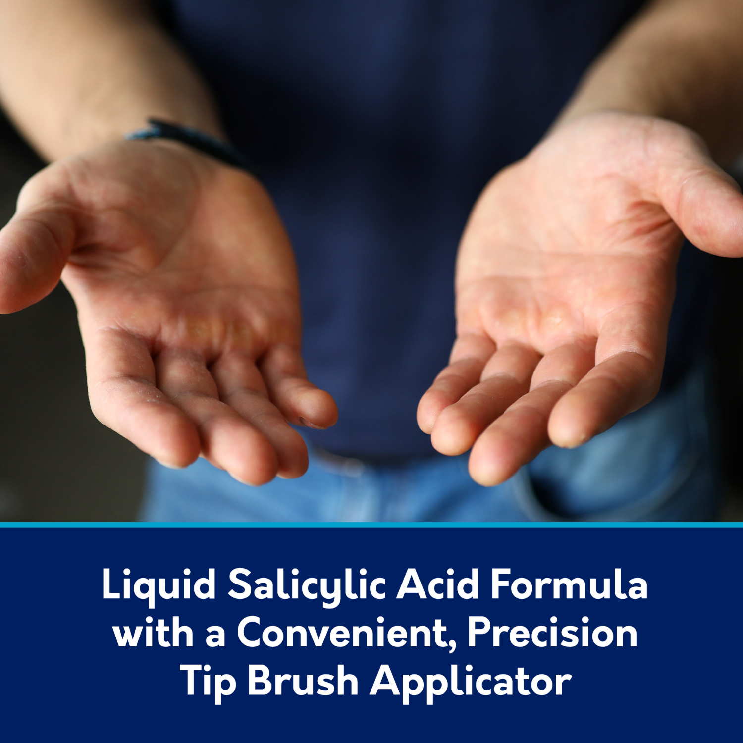 slide 4 of 5, Compound W Maximum Strength Fast Acting Liquid Wart Remover, 0.31 fl oz, 0.31 fl oz