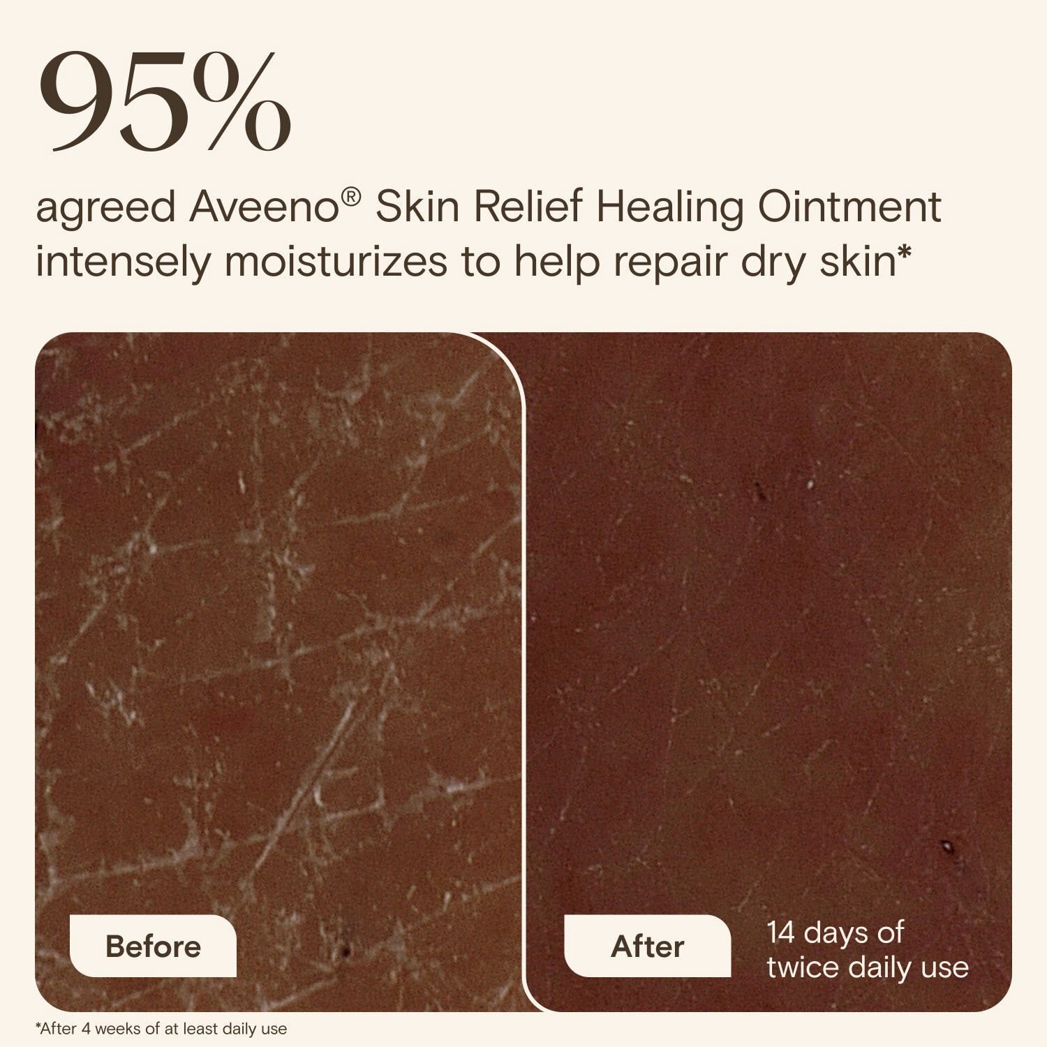 slide 4 of 7, Aveeno Skin Relief Healing Ointment, Fragrance-Free, 2.0 Oz, 2 oz