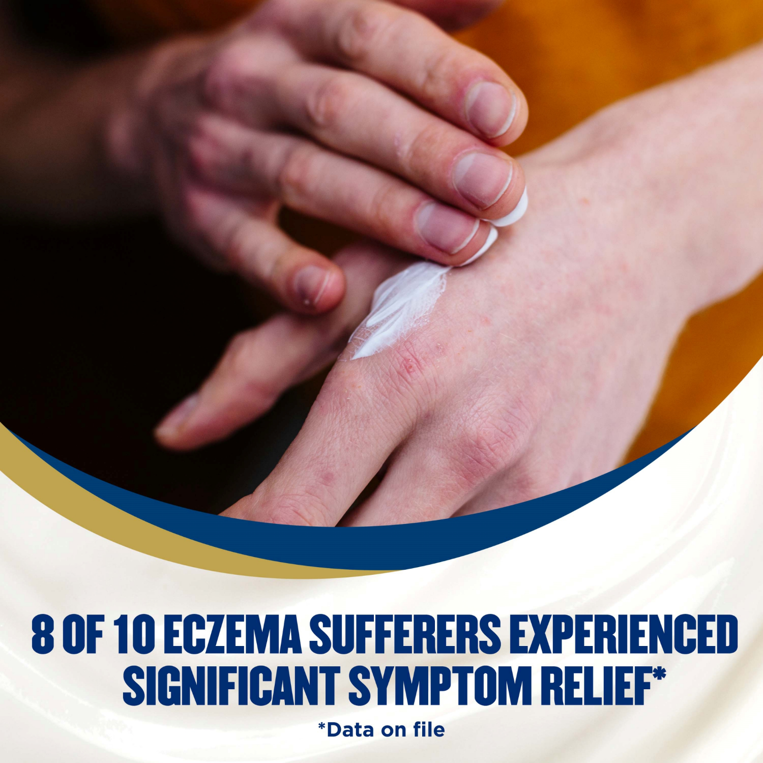 slide 3 of 5, Gold Bond Medicated Eczema Relief Cream (5.5 Oz), 5.5 oz