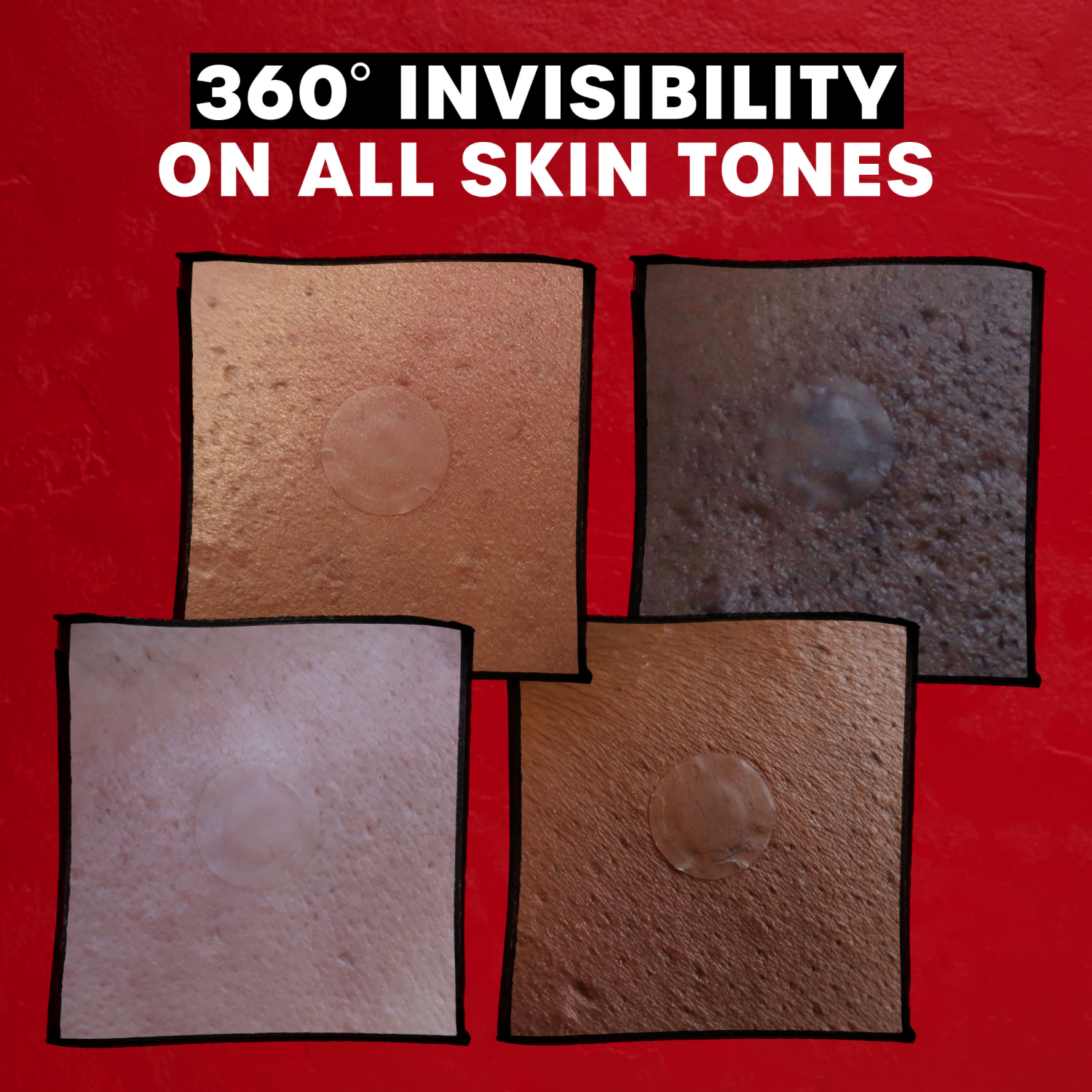 slide 2 of 4, Thayers Natural Remedies Invisible S.O.S Hydrocolloid Ultra-Thin Acne Pimple Patch - 22ct, 22 ct