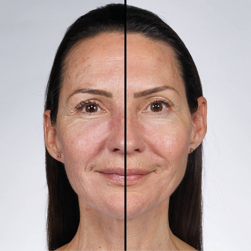 slide 6 of 7, No7 Future Renew Damage Reversal Serum 0.84 fl oz, 0.84 fl oz