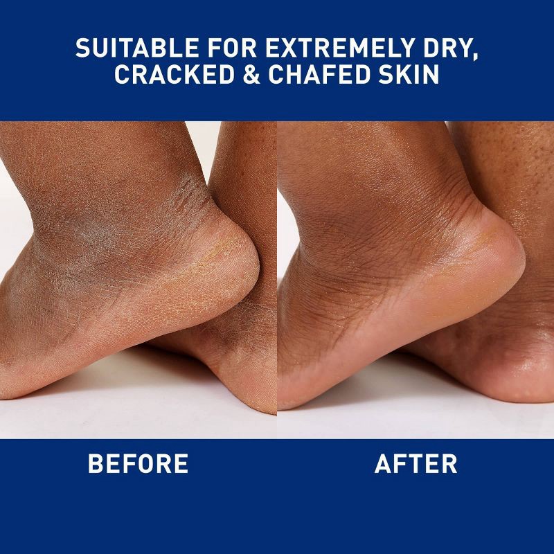 slide 5 of 13, CeraVe Healing Ointment Skin Protectant, Soothes Dry, Cracked and Chafed Skin, Non-Greasy Unscented - 12oz, 12 oz