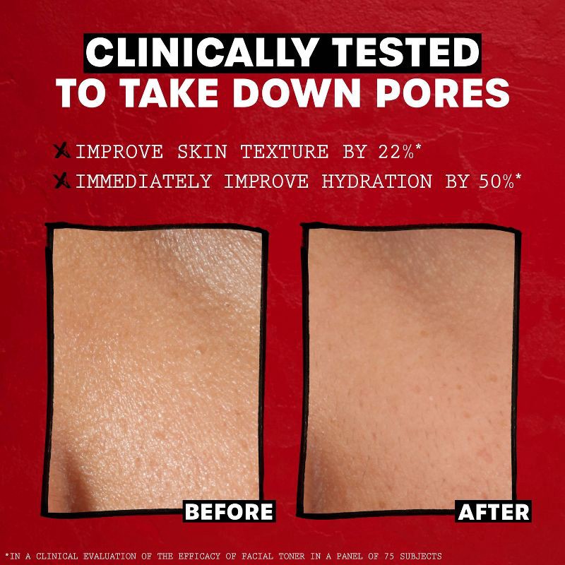 slide 5 of 9, Thayers Natural Remedies Witch Hazel Alcohol Free Toner with Rose Petal - 12 fl oz, 12 fl oz