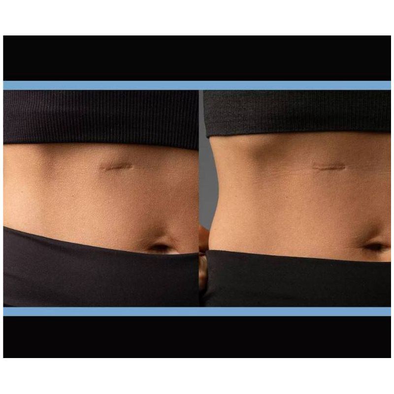 slide 3 of 7, ScarAway Scar Treatment Gel - .35oz, 0.35 oz