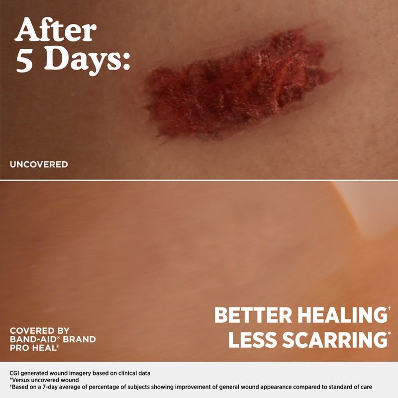 slide 6 of 9, Band-Aid Brand Hydro Seal Adhesive Bandages for Heel Blisters - 6ct, 6 ct