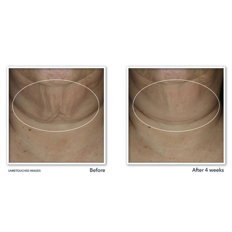 slide 7 of 10, RoC Derm Correxion Firming Serum Stick, 1 oz., 1 oz