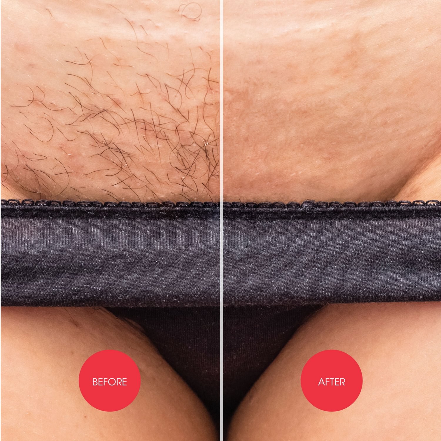 slide 2 of 5, Nad's NADS Nad's Down Under Hair Removal Cream, 5.1 Oz, 5.1 oz