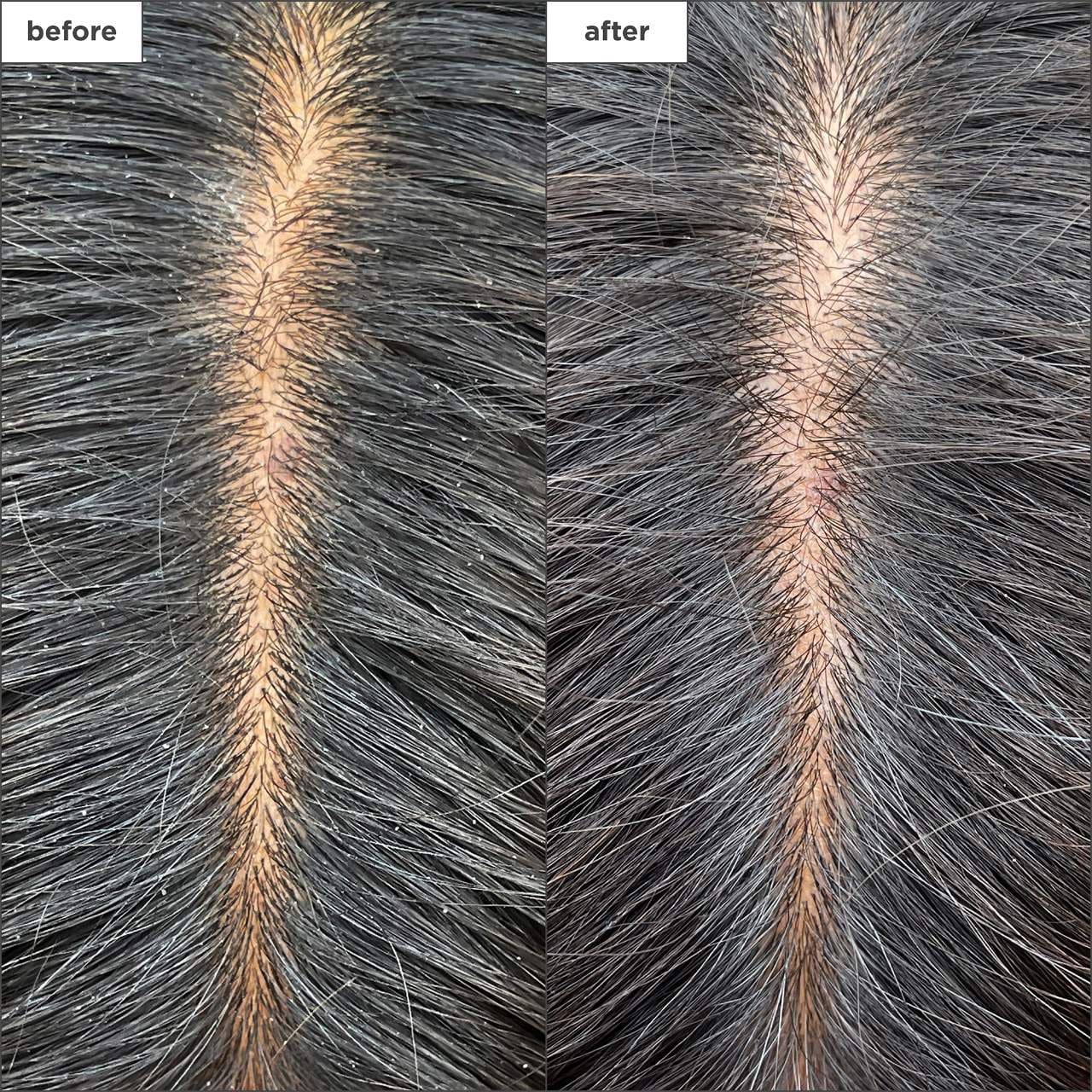 slide 2 of 8, Briogeo Scalp Revival™ Charcoal + Tea Tree Cooling Hydration Mask for Dry, Itchy Scalp 6 oz/ 177 mL,