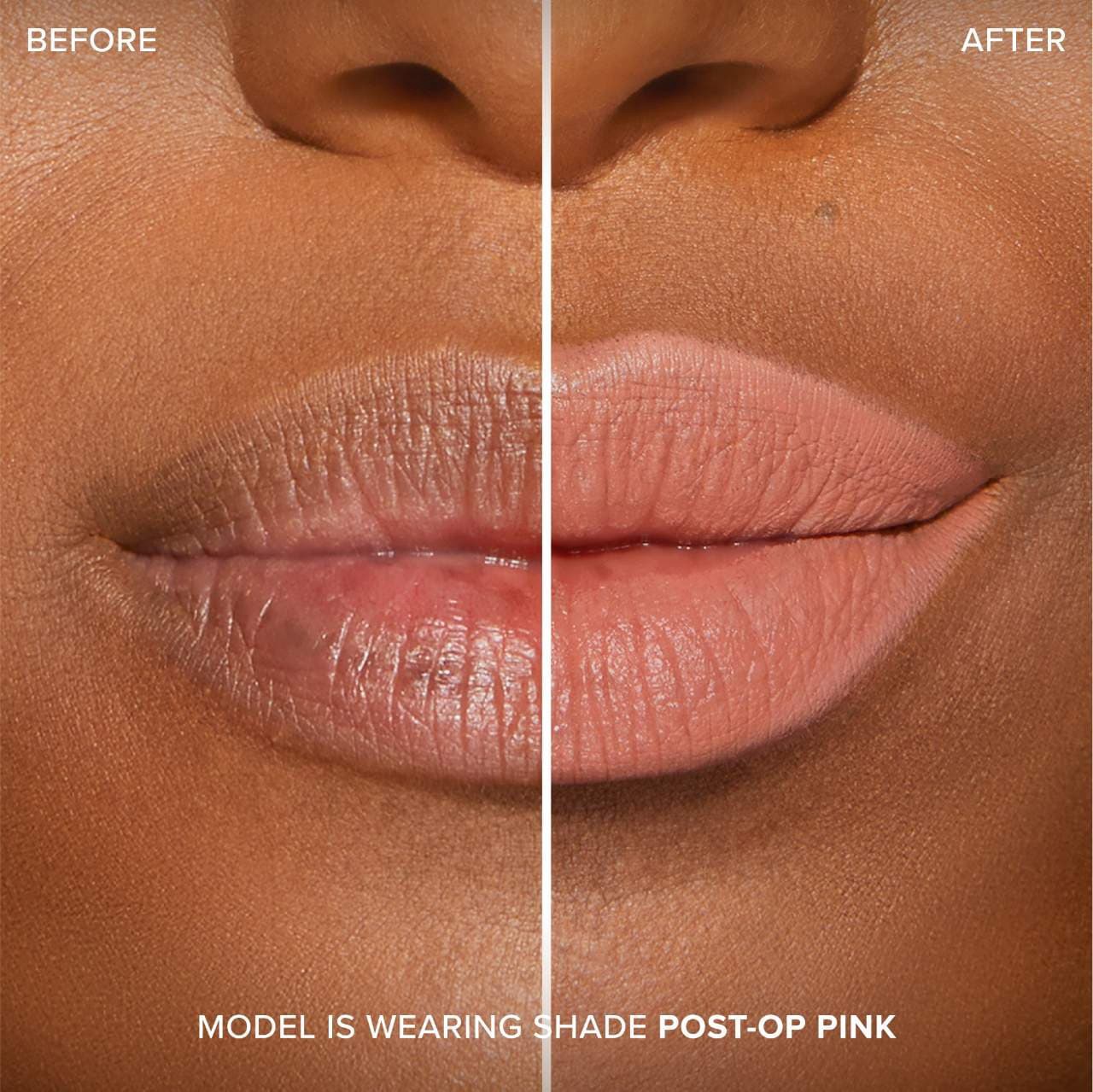 slide 6 of 10, Too Faced Lip Injection Extreme Lip Shaper Plumping Lip Liner Post-Op Pink, 