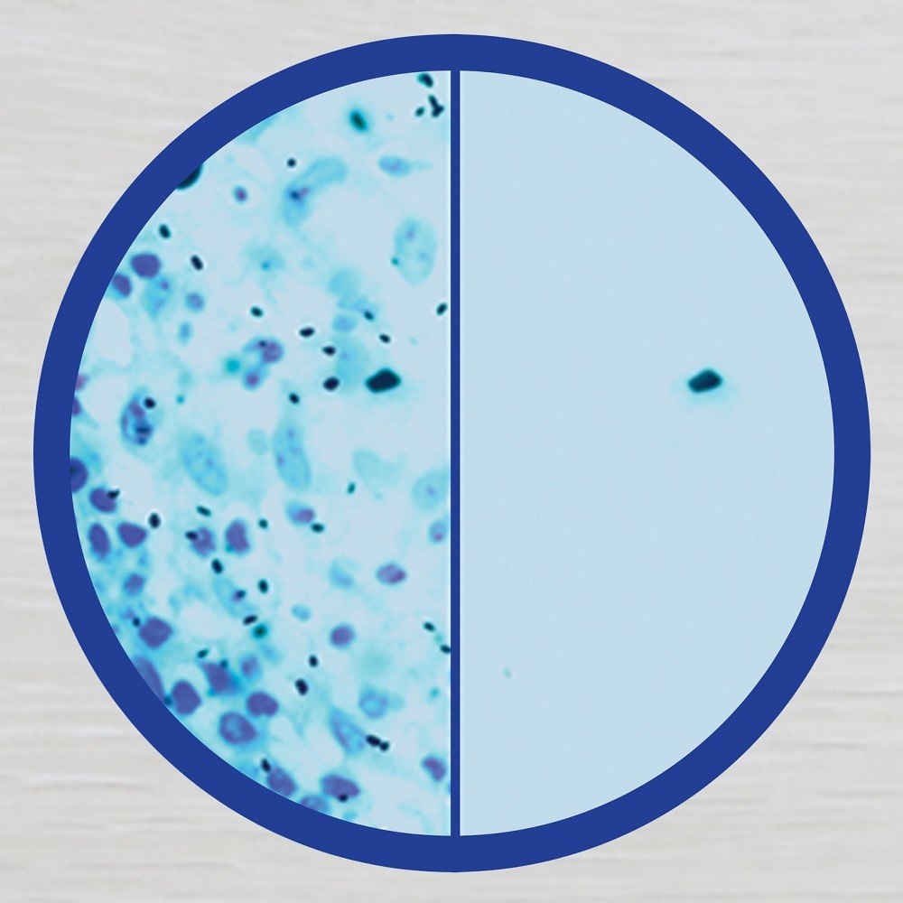 slide 10 of 10, Lysol Disinfectant Spray, Sanitizing and Antibacterial Spray, For Disinfecting and Deodorizing, Lemon Breeze, 19 Fl Oz., 19 oz