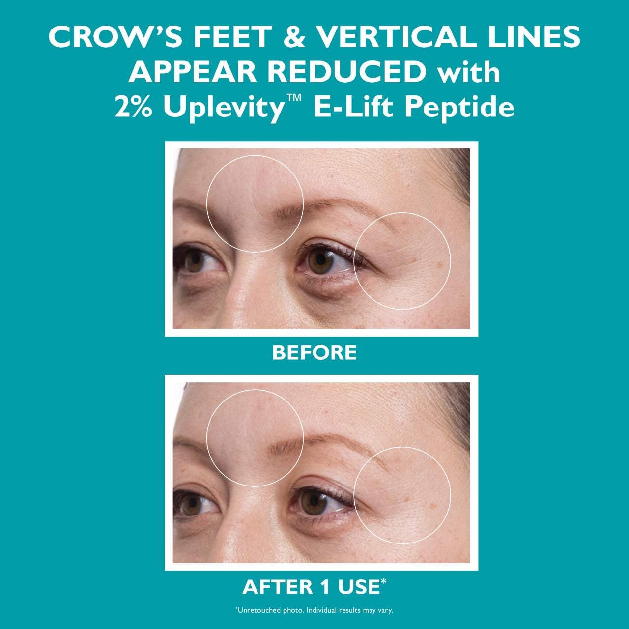 slide 6 of 11, Peter Thomas Roth Peptide Skinjection Hydra-Gel Patches 60 patches / pack, 