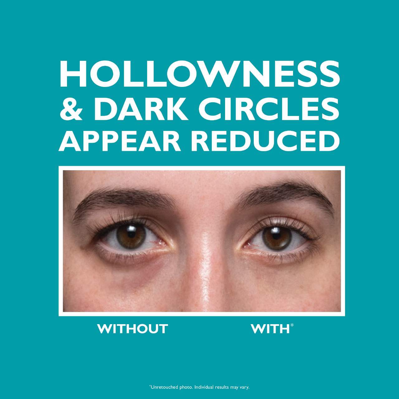 slide 4 of 11, Peter Thomas Roth Peptide Skinjection Fill + Fix Under Eye Cream 0.5 oz / 15 mL, 