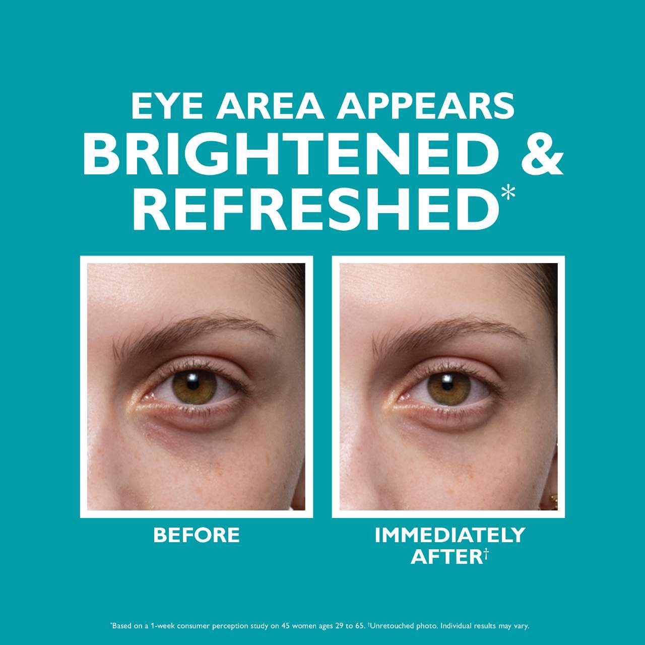 slide 8 of 11, Peter Thomas Roth Peptide Skinjection Fill + Fix Under Eye Cream 0.5 oz / 15 mL, 