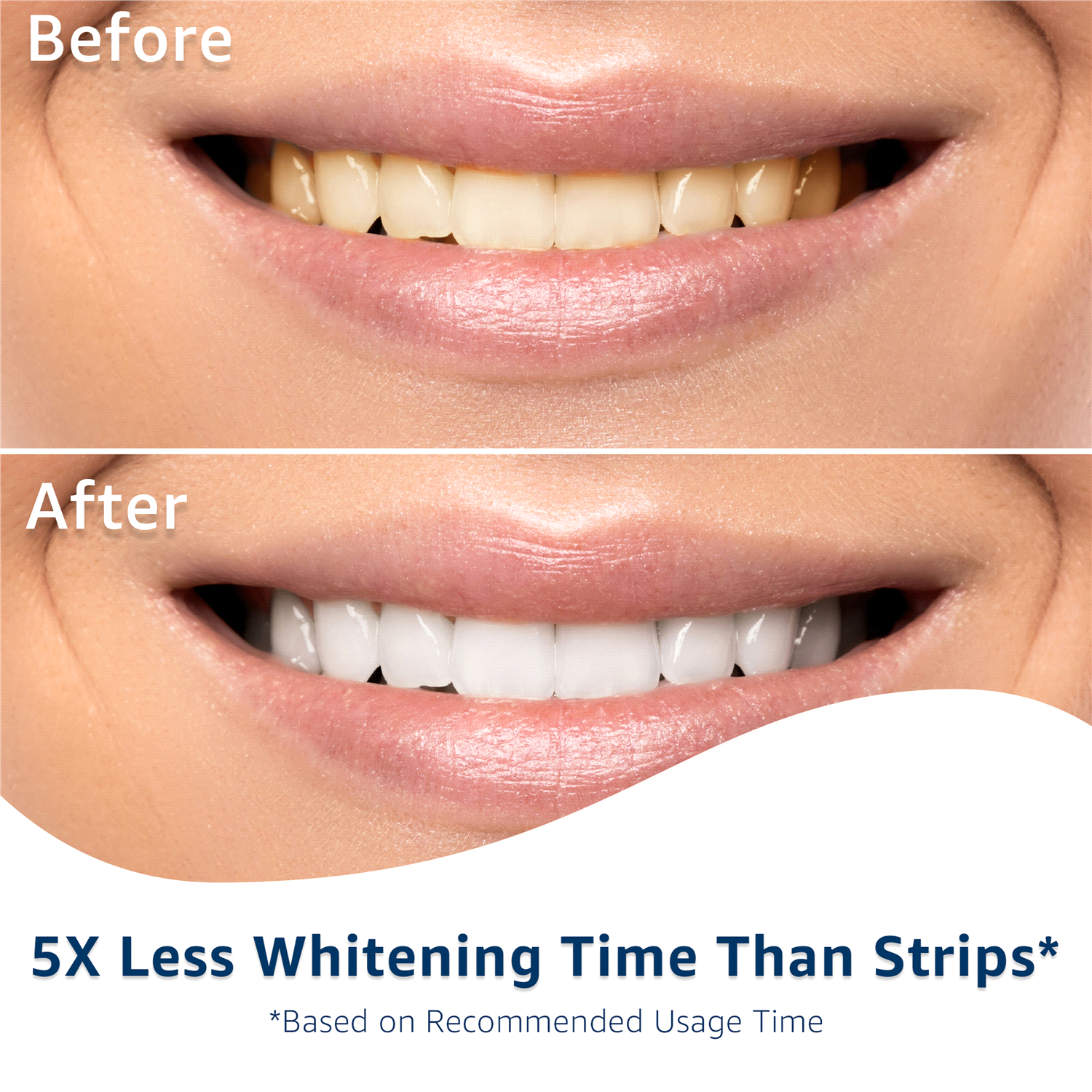 slide 3 of 4, Meijer LED Light Teeth Whitening Kit​, Blue Light Accelerates Whitening Results, LED Light Whitening Mouth Tray with Whitening Gel Pens, 1 Kit, 1 ct