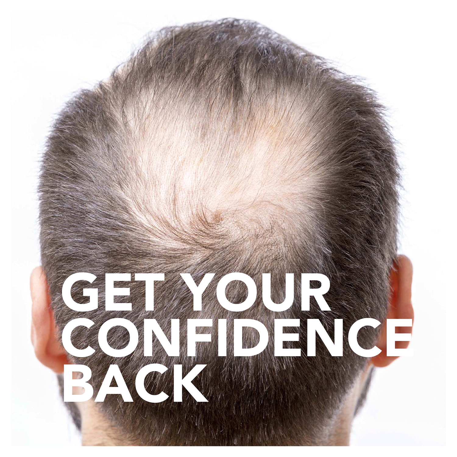 slide 5 of 5, Meijer Minoxidil Topical Solution USP, 5 Percent, Hair Regrowth Treatment for Men, Extra Strength, 3 btl., 6 oz