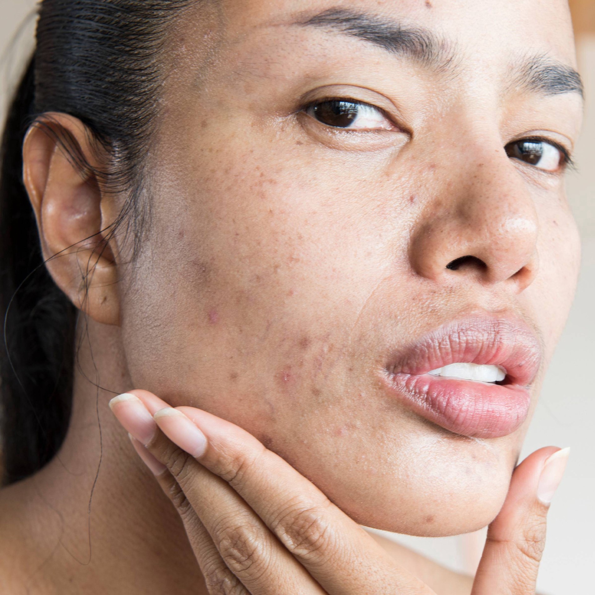 slide 17 of 17, Neutrogena Stubborn Texture Daily Acne Facial Cleanser, Salicylic Acid Face Wash + Glycolic & Polyhydroxy Acids, Fragrance-Free, 6.3 fl. oz, 6.3 fl oz