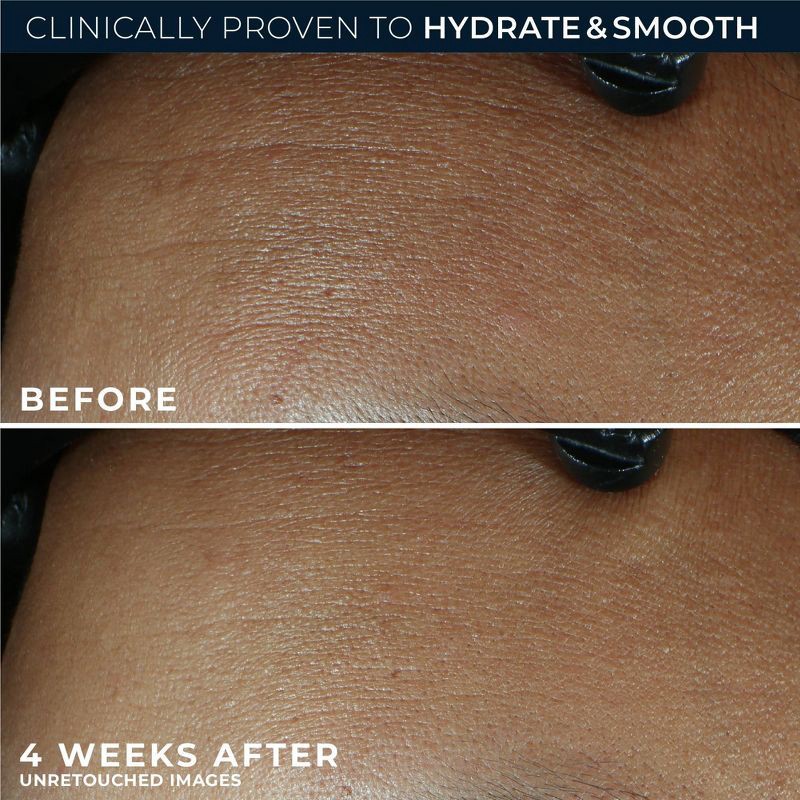 slide 4 of 11, RoC Retinol Correxion Line Smoothing Max Hydration Cream - 1.7oz, 1.7 oz