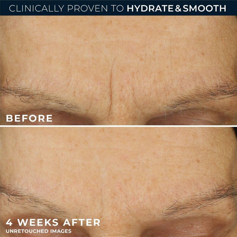slide 5 of 11, RoC Retinol Correxion Line Smoothing Max Hydration Cream - 1.7oz, 1.7 oz