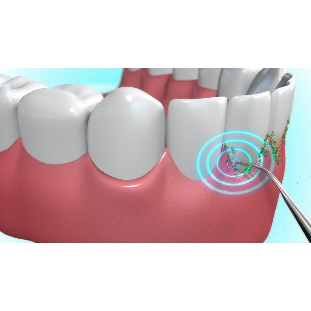 slide 4 of 7, Sonic Pic Dental Cleaning System, 1 ct