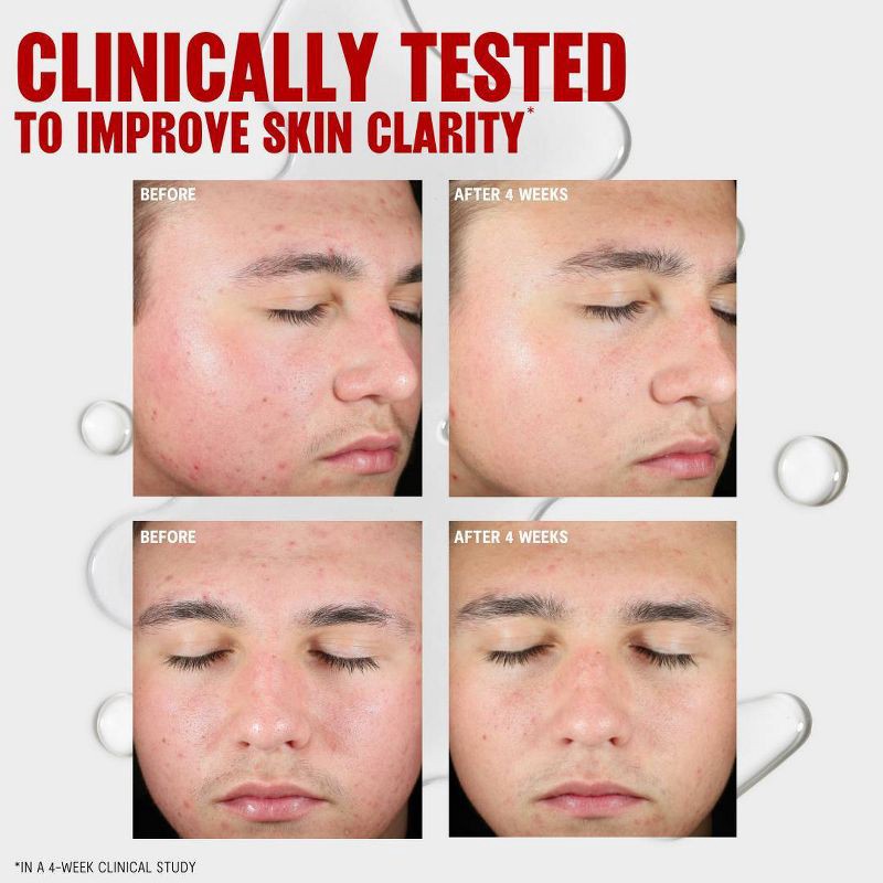 slide 6 of 9, Thayers Natural Remedies Clearing Toner With Salicylic Acid - 12 fl oz, 12 fl oz